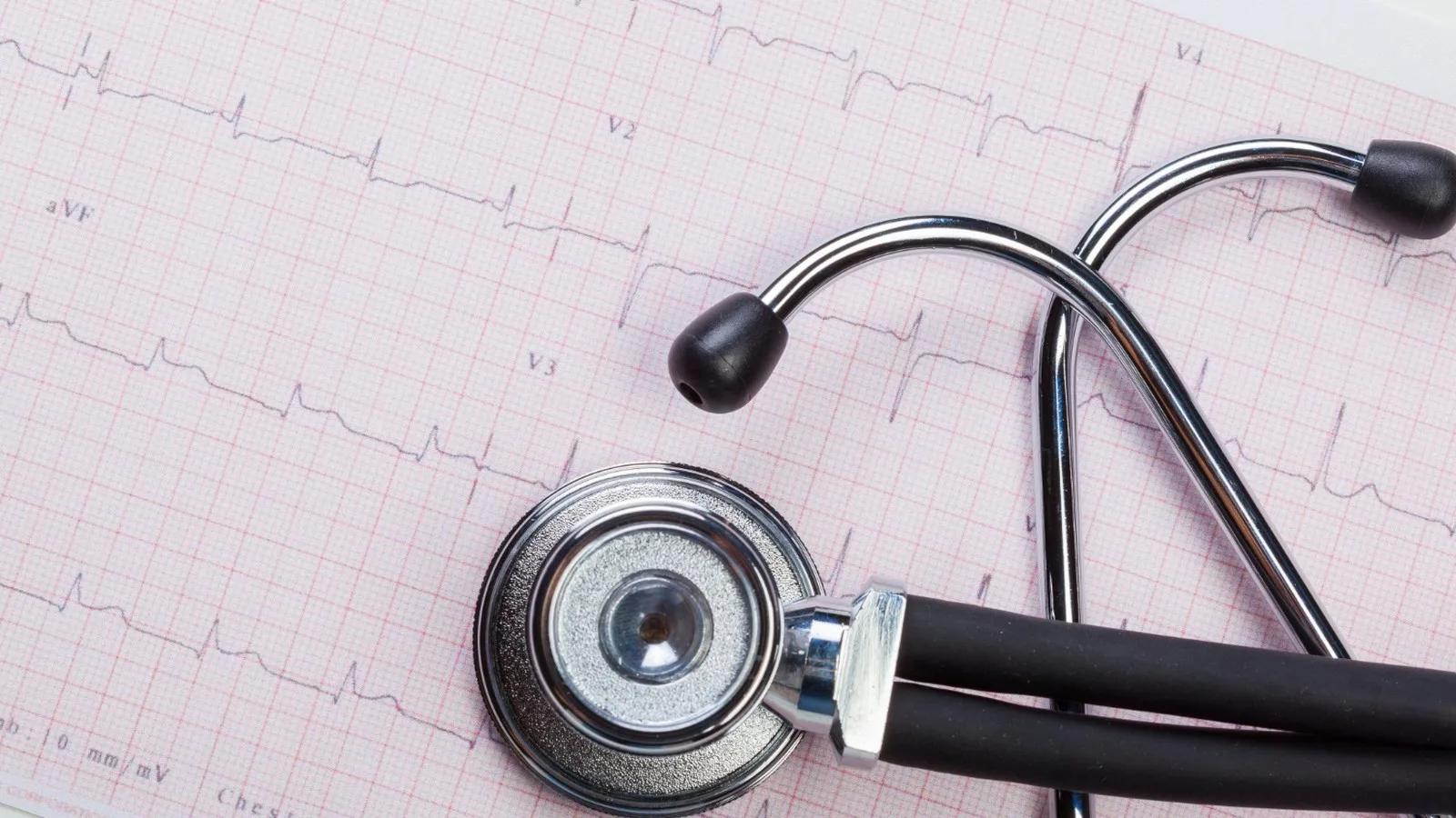 ¿Qué médico trata hipertensión arterial?
