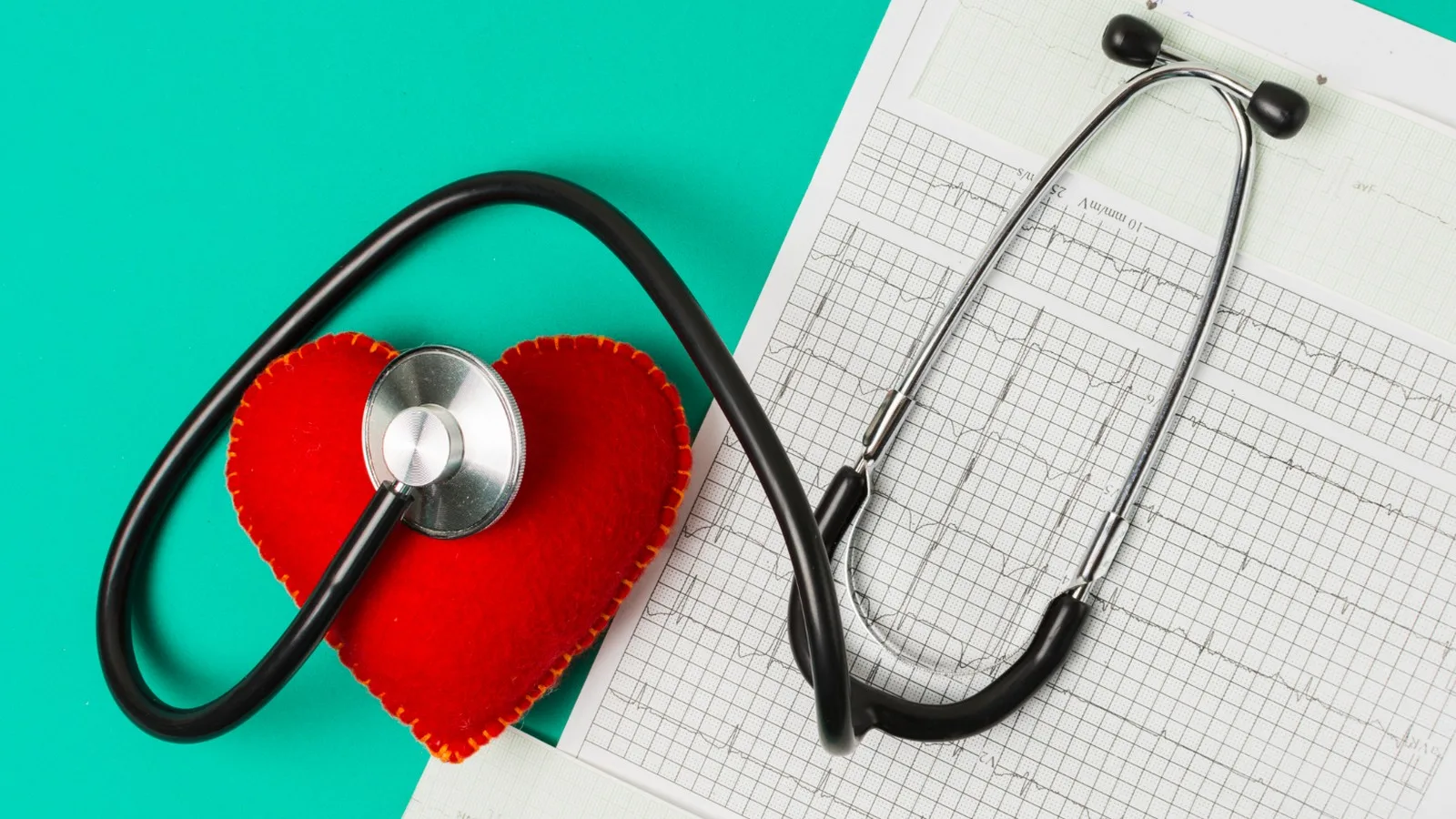 ¿Qué médico trata infarto?